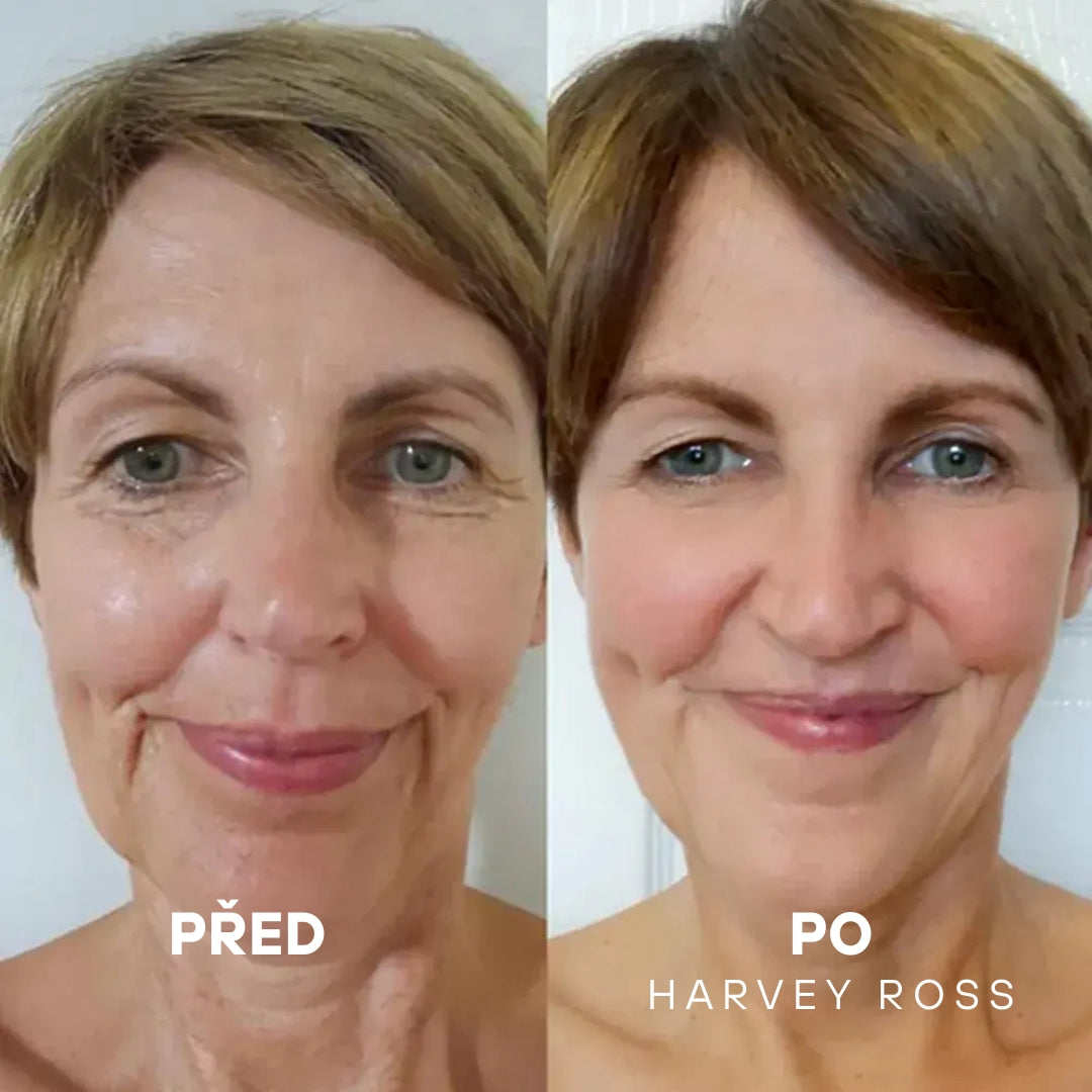 Harvey Ross - Instant Lift+